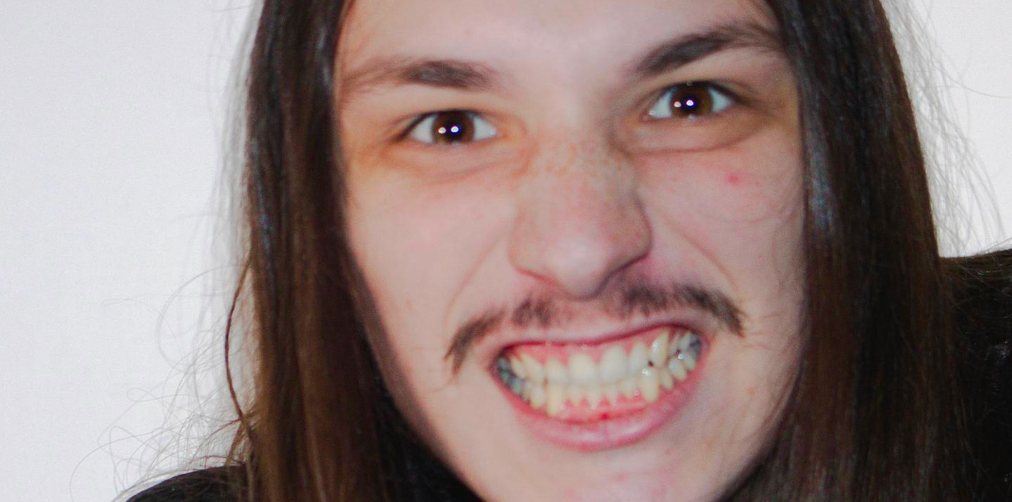 Close up of a man baring his teeth